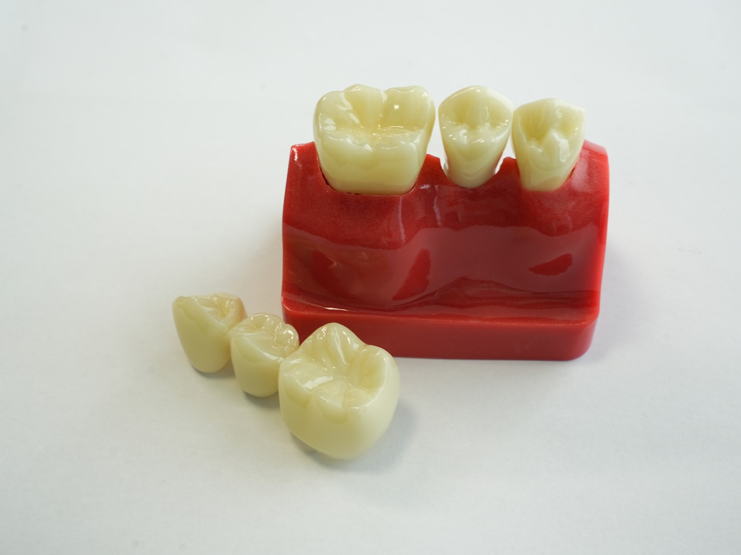 Dental Implant Teeth Model