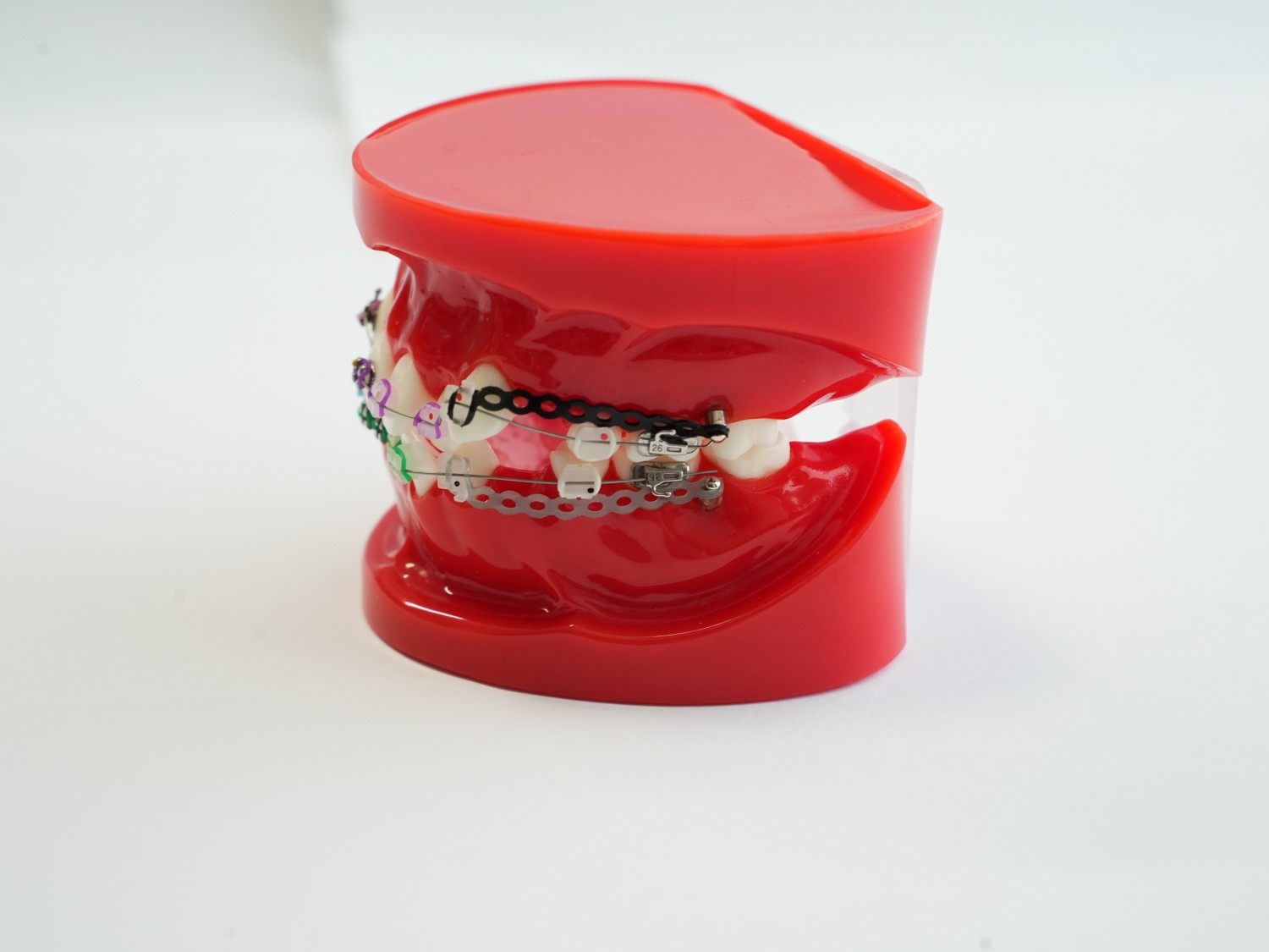 Orthodontics Teeth Model