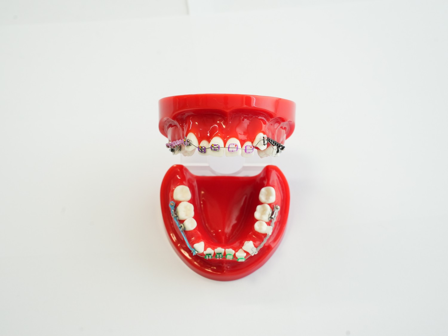 Orthodontics Teeth Model