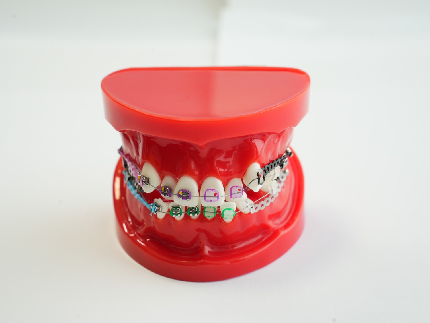 Orthodontics Teeth Model