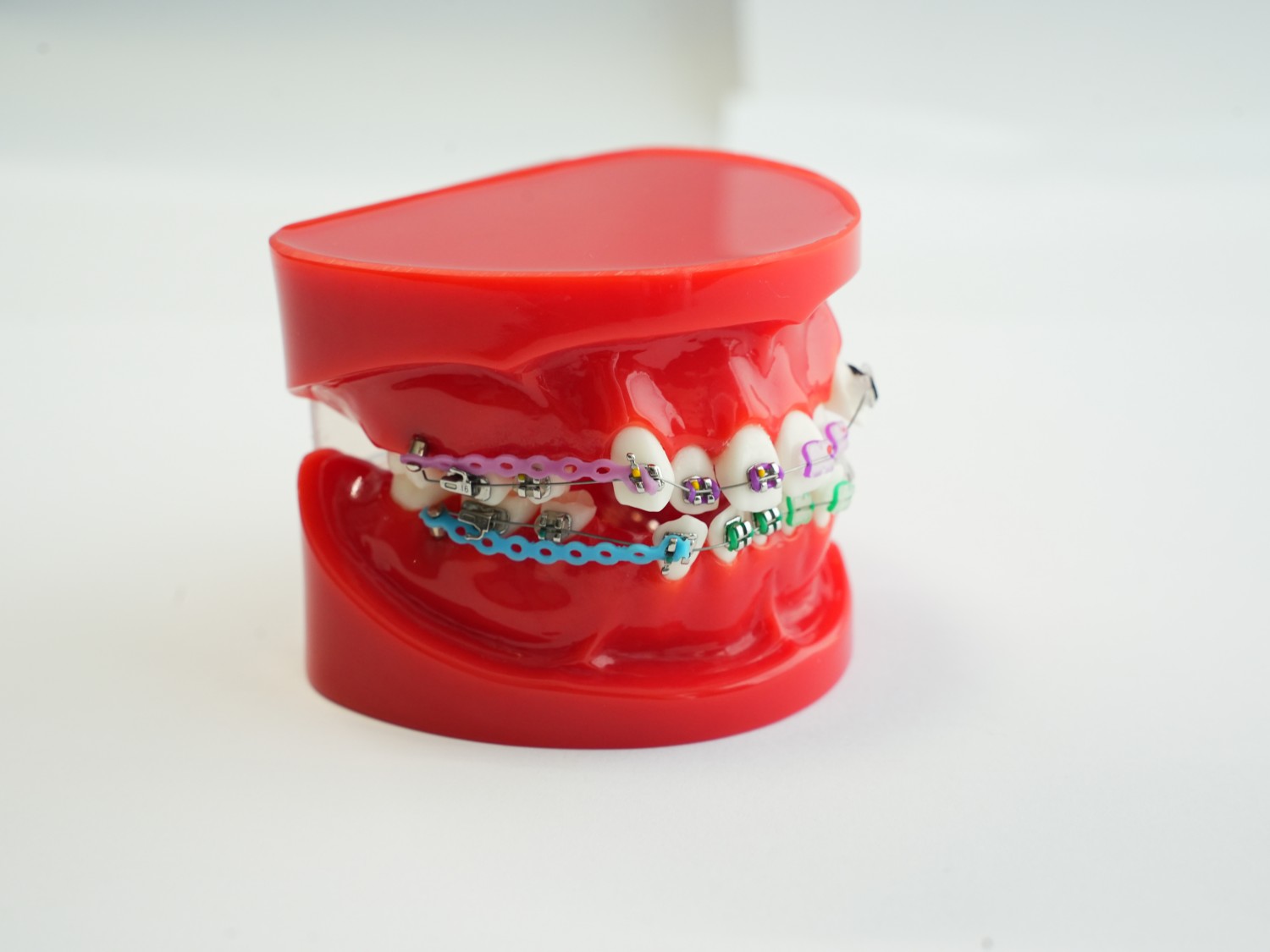 Orthodontics Teeth Model