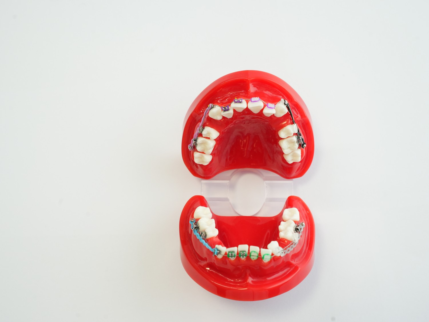 Orthodontics Teeth Model